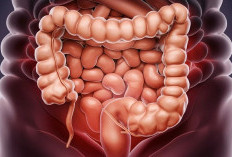 5 Makanan Ini Bantu Menjaga Kesehatan Usus