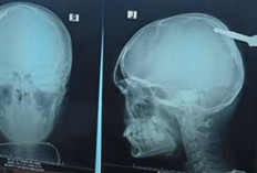 Desak Polisi Usut Tuntas Pelaku