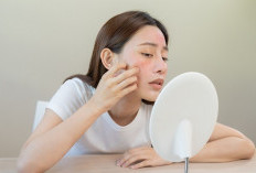 Cara Ampuh Hilangkan Kemerahan di Wajah: Tips Alami dan Perawatan Cepat