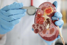 Waspadai! 4 Kebiasaan Pagi yang Diam-diam Bisa Merusak Ginjal, Nomor 1 Sering Diabaikan