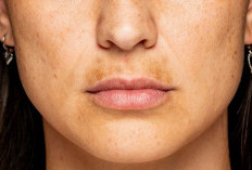 Cara Menghilangkan Kulit Gelap di Area Bibir dan Dagu