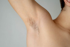 Cara Menghilangkan Bulu Ketiak Permanen: Kenali Perbedaan Terapi Laser dan Elektrolisis