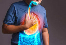 Atasi Asam Lambung Naik dengan 5 Cara Alami 