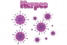 Penyebab Herpes Zoster