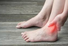 3 Pengobatan Alami untuk Asam Urat yang Membandel