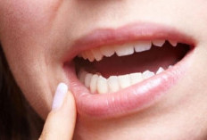 6 Tips Hilangkan Noda Bekas Kopi di Gigi 
