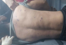 Pekerja Meninggal Diserang Tawon, Saat Gunakan Alat Berat 