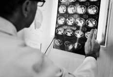 Peneliti: Obat Minyak Zaitun Berpotensi Mengobati Kanker Otak yang Mematikan