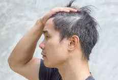 Atasi Uban Secara Alami, Coba dengan Tiga Bahan Dapur 