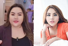 Lisa Mariana Akan Operasi Potong Lambung 