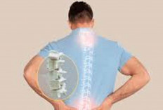3 Makanan Ini Bisa Tingkatkan Risiko Serangan Osteoporosis