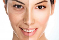 4 Makanan Bisa Percepat Penuaan Kulit,  Jangan Konsumsi Berlebihan