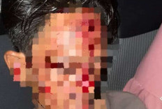 Video Pria Luka Parah Viral di Medsos