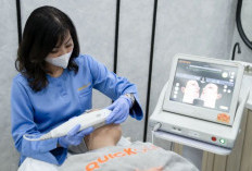 UltheraPrime: Teknologi Estetika Terbaru Peremajaan Wajah Tanpa Operasi Bedah