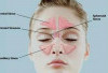 Bahan Alami Ini Bikin Sinusitis Kabur
