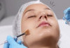 Peeling Wajah, Rahasia Kulit Cerah dan Halus: Kenali Jenis dan Risikonya