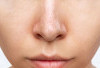 Mengenal Sebaceous Filament: Bukan Komedo, tapi Bagian Alami dari Kuli